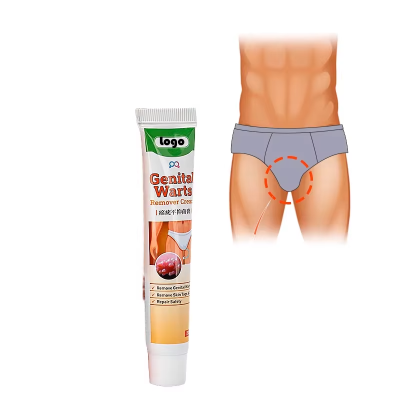Genital Wart Cream Effective Treatment Wart Remover Ointment Skin Tags and Warts Remover for Health Care